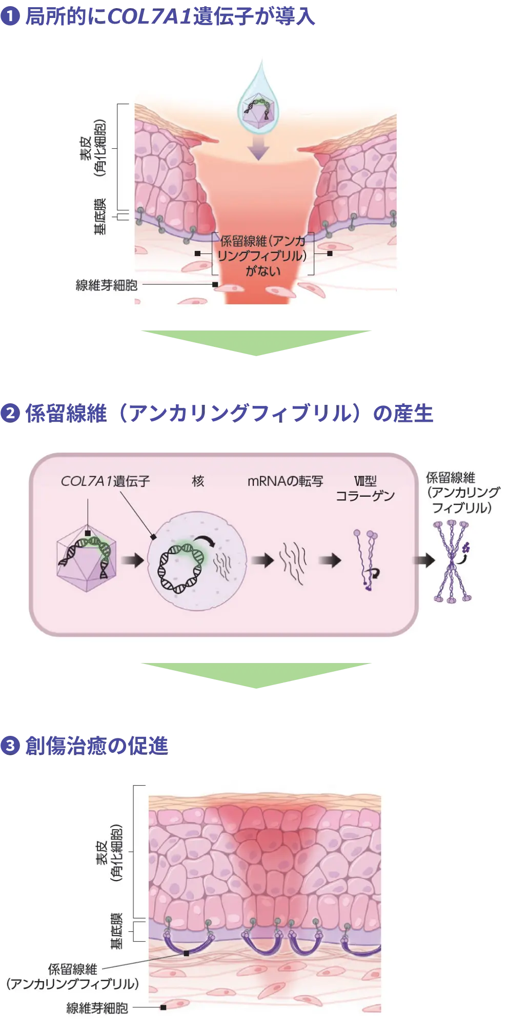 COL7A1遺伝子が傷口に局所的に導入され、治癒を促す治療の流れを示した図