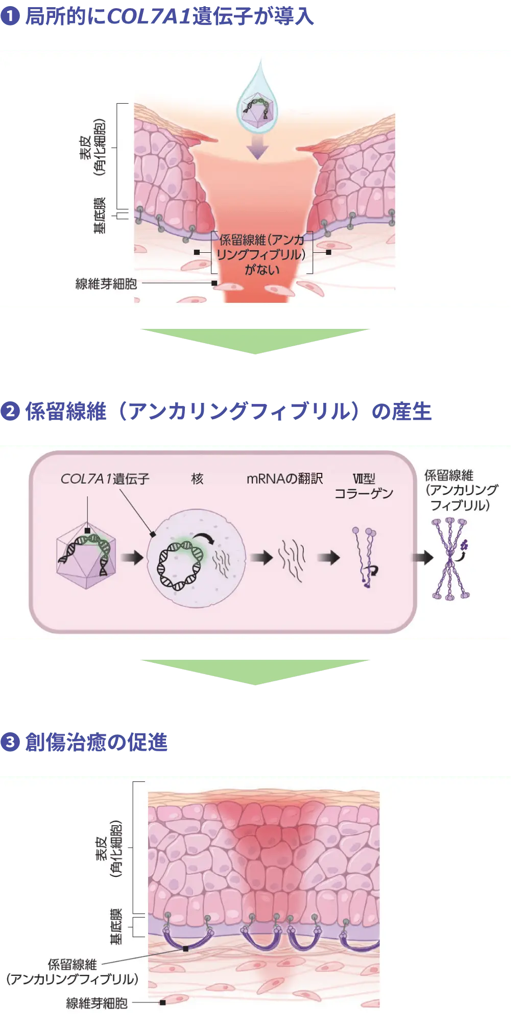 COL7A1遺伝子が傷口に局所的に導入され、治癒を促す治療の流れを示した図