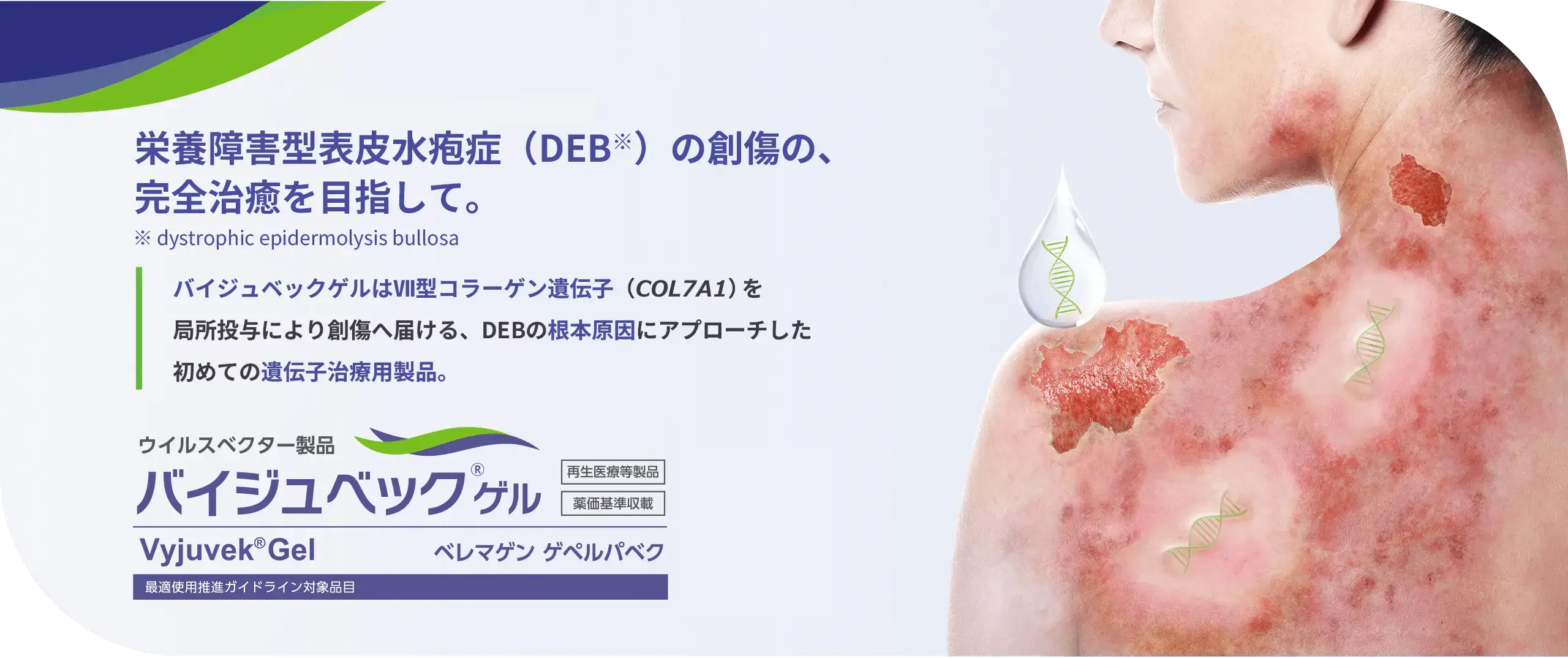 栄養障害型表皮水疱症（DEB）の創傷の、完全治癒を目指して。ウイルスベクター製品、バイジュベックゲル